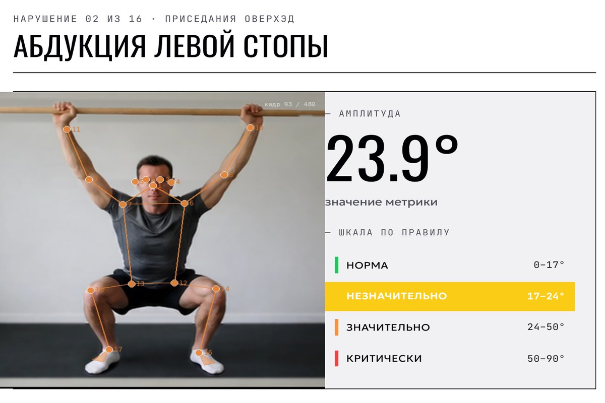 Разворот отчёта: абдукция левой стопы