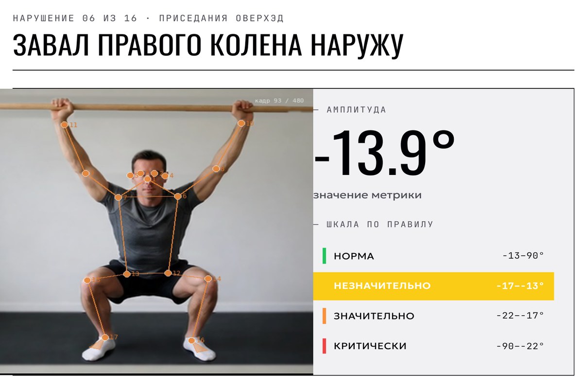 Разворот отчёта: завал правого колена наружу