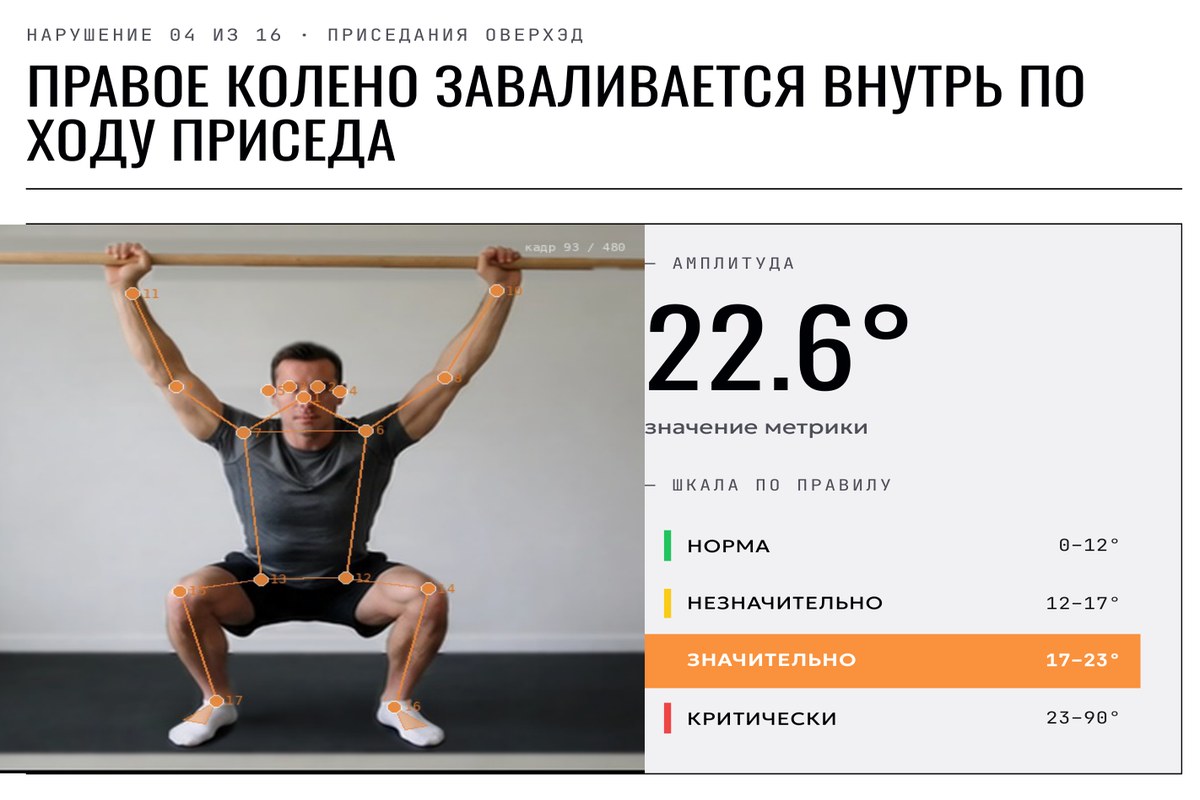 Разворот отчёта: правое колено заваливается внутрь